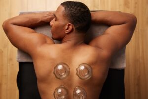Ventouses dos : bienfaits, récupération et cupping sportif